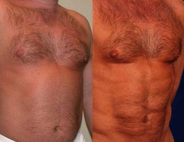 http://reho.st/preview/visboo.com/img/new/surgery_03.jpg