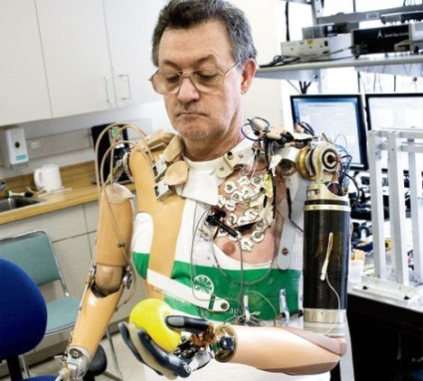 http://reho.st/preview/www.ubergizmo.com/photos/2007/6/bionic-arm.jpg