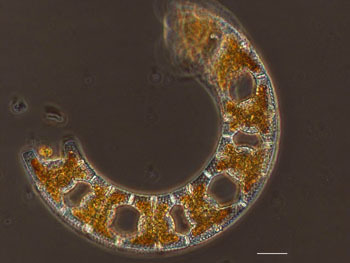 http://reho.st/preview/www2.cnrs.fr/sites/journal/image/keops_phytoplancton_hd.jpg