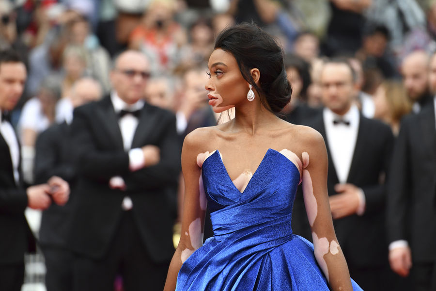 http://reho.st/resize-parismatch.ladmedia.fr/r/901,,forcex/img/var/news/storage/images/paris-match/people/cannes-2017-les-bombes-debarquent-sur-la-croisette-1260869/node_1260929/21147131-1-fre-FR/_1.jpg