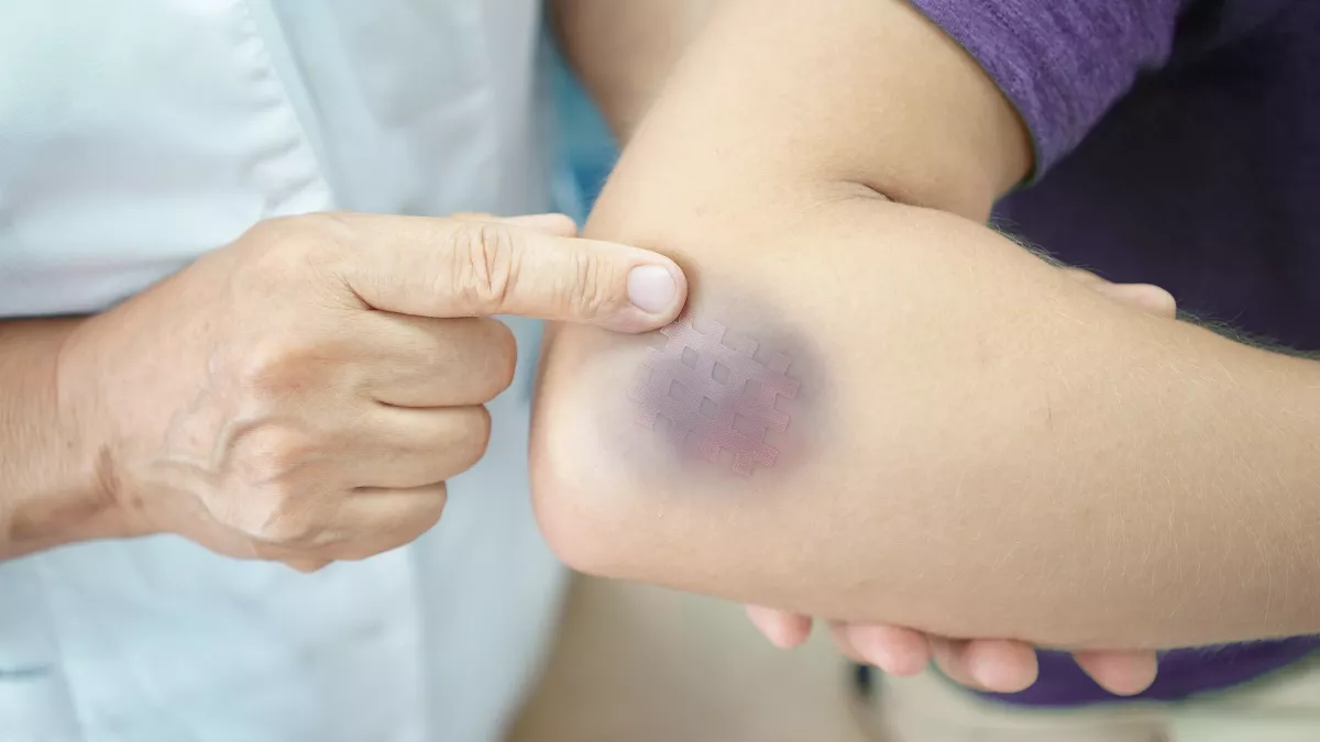 https://reho.st/https://img.passeportsante.net/1200x675/2021-05-03/i105410-ecchymoses-hematomes-symptome.webp