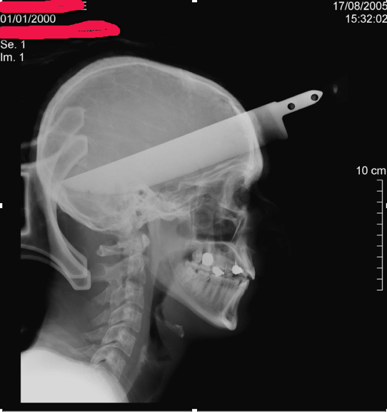 https://reho.st/self/ec34e71fb9af224c5966d86746d292ad07ff948b.png